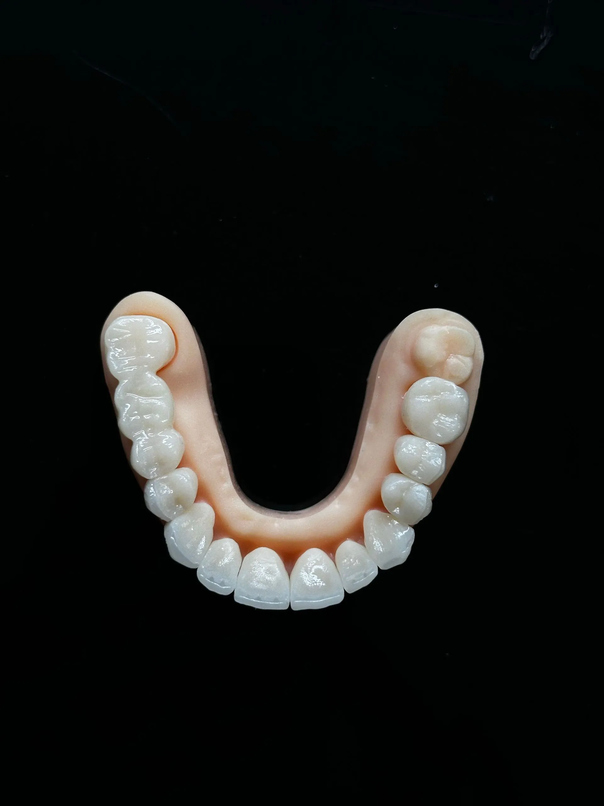 Modelo de prótesis dental completa sobre fondo oscuro